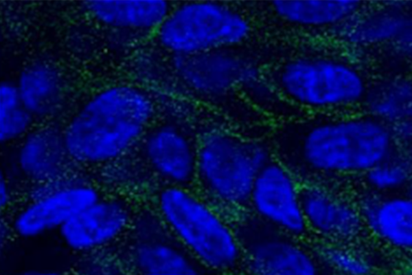 緑:Carboxypeptidase M