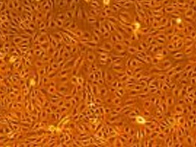 正常ヒト血管内皮細胞と低血清増殖用培地