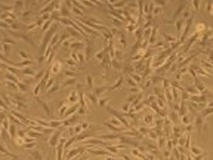 正常ヒト骨格筋サテライト細胞と、専用増殖・分化培地