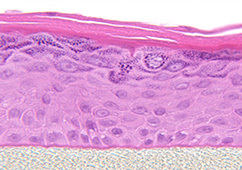 表皮モデル EPI