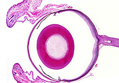 スーパーフィックス