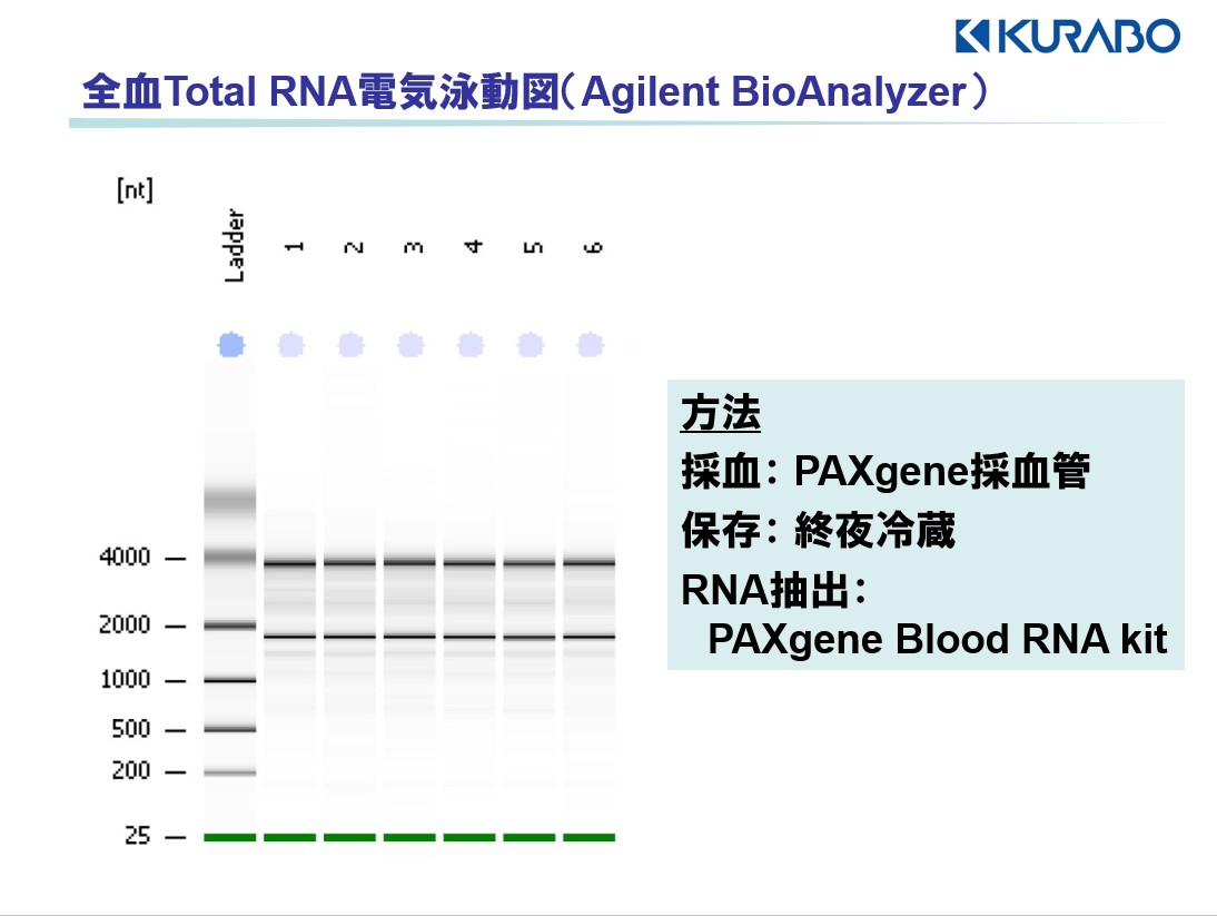 全血 Total RNA　電気泳動図（Agilent BioAnalyzer）